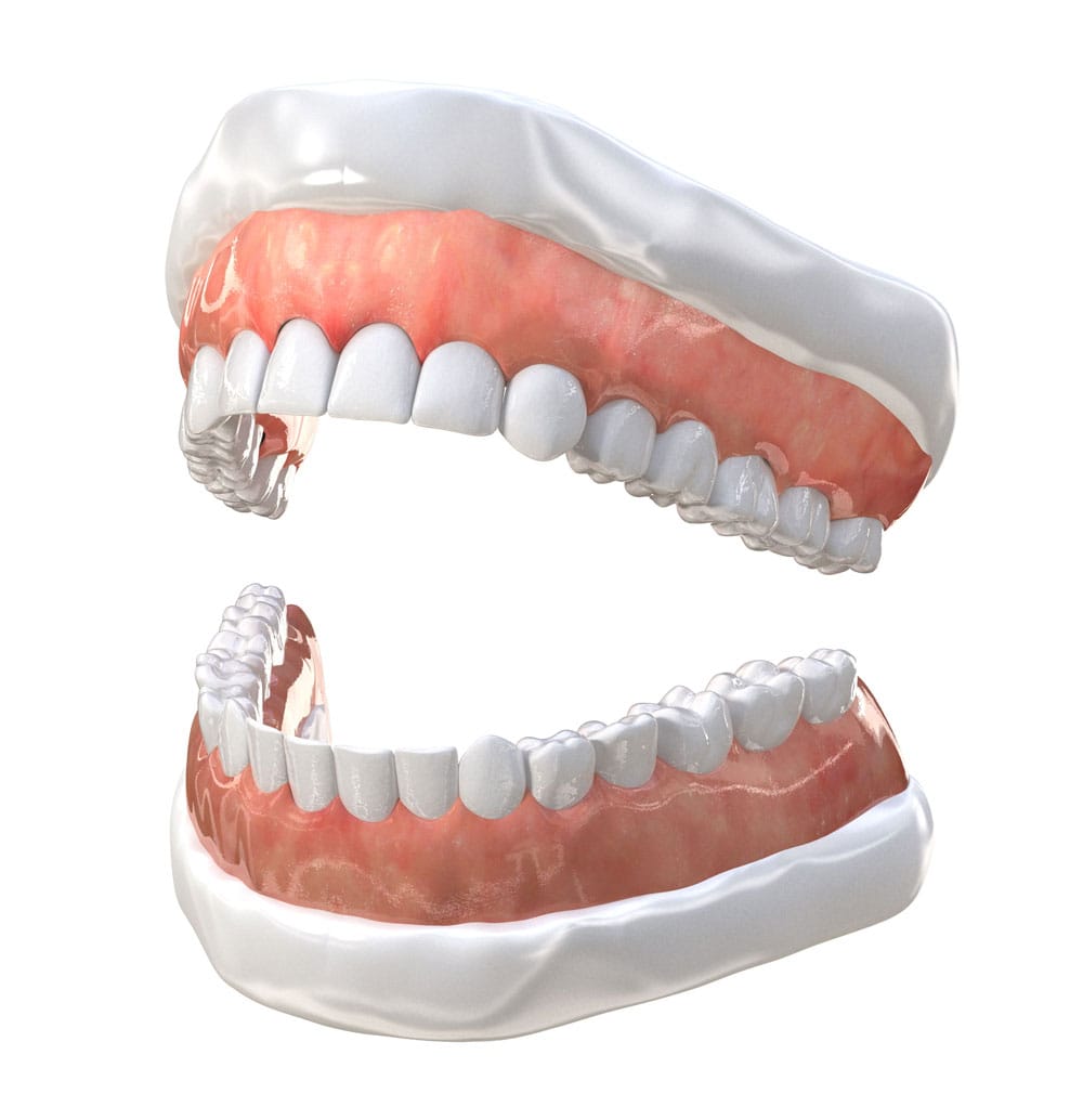 Contact our dental office to see if you are a candidate for complete and partial dental dentures in Coral Gables, FL. AVM Dentistry offers removable teeth replacement with complete and partial dental dentures near Coral Gables, FL today. Dentures in Coral Gables, FL